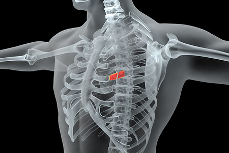 胸外科胸部肋骨骨折场景设计图片