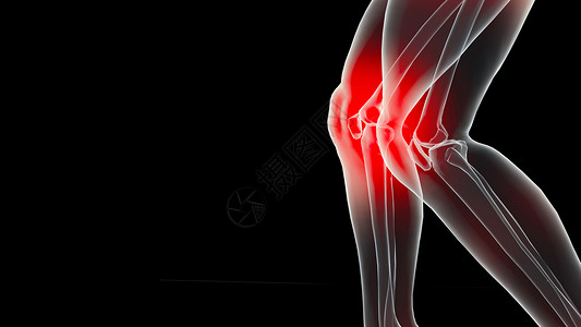 C4D膝关节疼痛场景设计图片