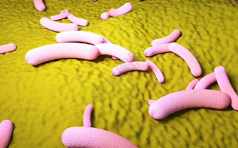 幽门螺杆菌病毒溃疡高清图片
