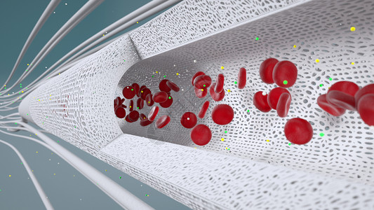 血管搭桥血液科技高清图片