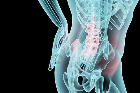 急性腰扭伤C4D腰椎病背景设计图片