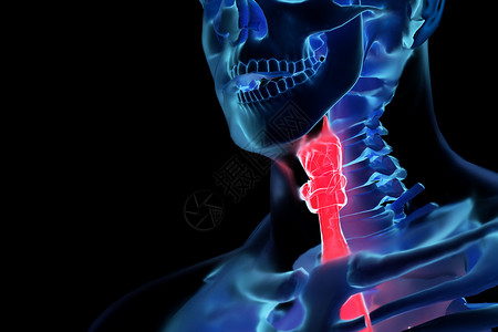 支气管炎C4D咽喉炎背景设计图片