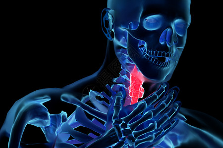 骨骼发炎C4D咽喉炎背景设计图片
