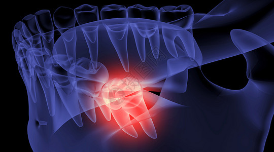 骨骼牙齿口腔智齿疼痛设计图片