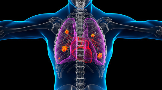 病毒扫描肺部感染人体模型设计图片