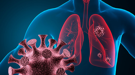 肺部透视新冠肺炎场景设计图片