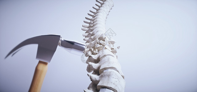 弯曲杆菌病3D脊椎病场景设计图片