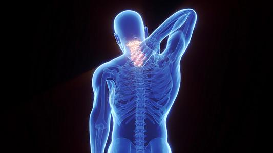 弯曲肌肉3D颈椎病场景设计图片