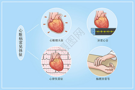 常见的scad心脏病常见体征医疗插画插画