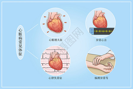 心脏病常见体征医疗插画图片