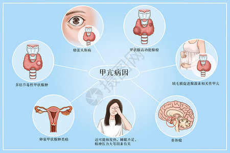 功能医学甲亢病因医疗插画插画