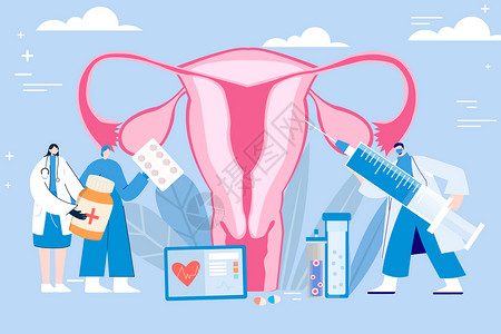 针式打印机子宫卵巢妇科疾病矢量插画插画