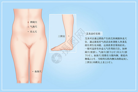 治疗图艾灸治疗宫寒医疗插画插画