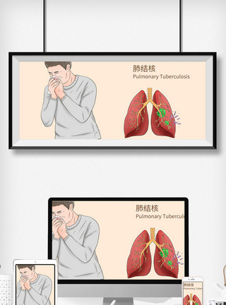 慢性咳嗽肺结核病科普医疗插画模板