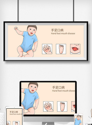 健康小孩手足口病科普医疗插画模板