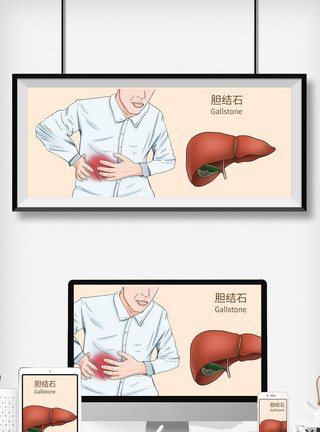 肚子疼图片胆结石科普医疗插画模板