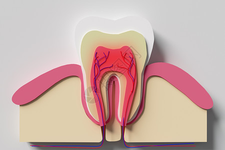 牙本质敏感牙齿横截面模型设计图片