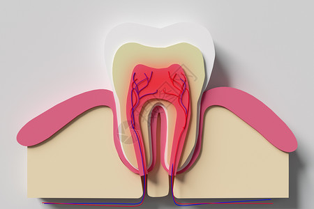 敏感牙齿横截面模型设计图片