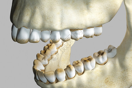 三维牙齿牙渍背景图片