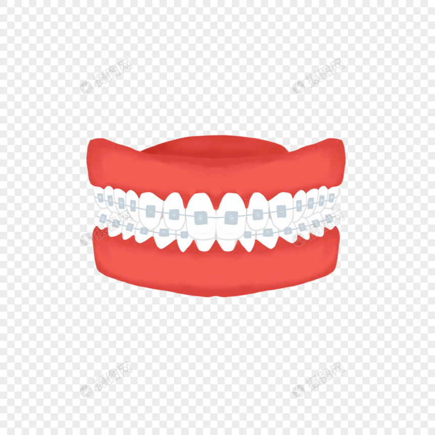 牙套牙齿模型牙齿矫正立体图片