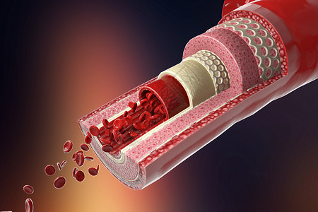 3D血管结构高清图片
