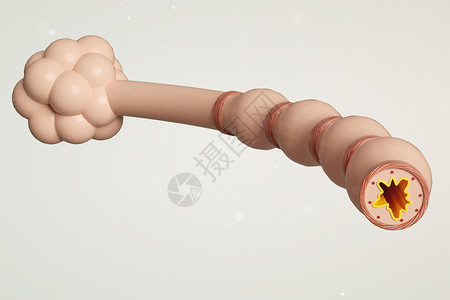 三维肺气肿微观终末细支气管设计图片