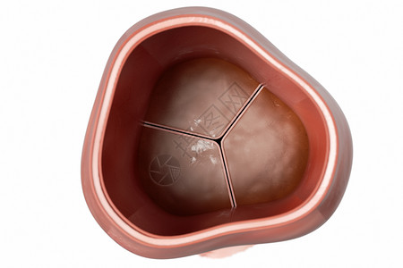 桔瓣主动脉瓣膜关闭场景设计图片