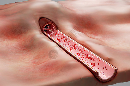 子宫内膜组织三维动脉组织场景设计图片