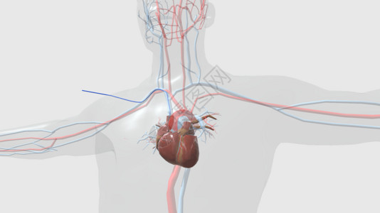 插入素材库锁骨静脉插入心脏导管设计图片