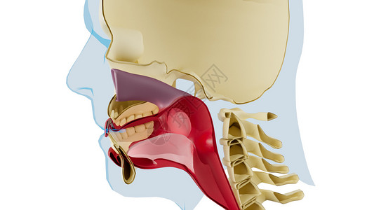 喉咙肿胀(过敏反应)高清图片