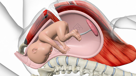 剖腹产子宫胎儿高清图片
