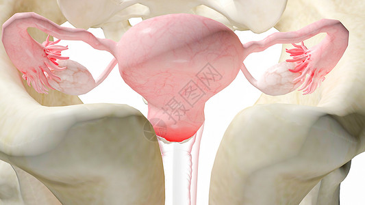 左圆韧带衣原体盆腔疼痛和炎症设计图片