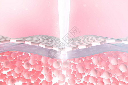 小分子玻尿酸皮肤激光治疗场景设计图片