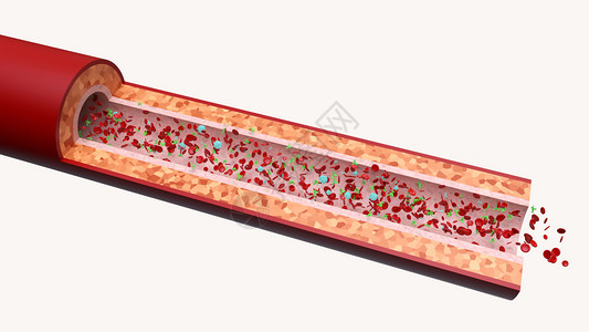 白血球血流抗核抗体设计图片