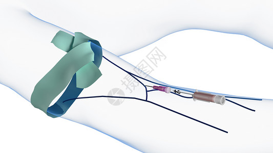 静脉导管静脉注射针头取出设计图片