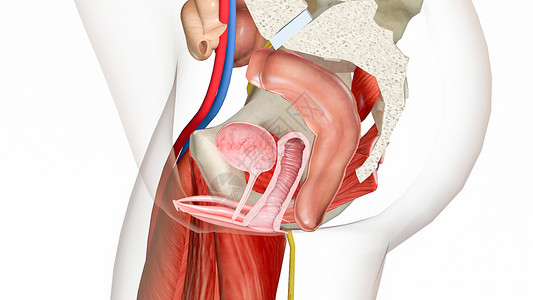 右环肌腱阴道金库脱垂0级设计图片