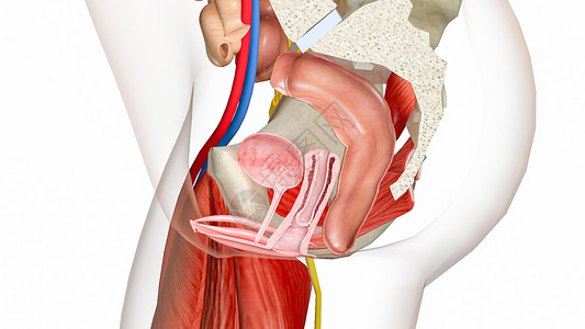 右侧肛提肌腱弓阴道金库脱垂2级设计图片