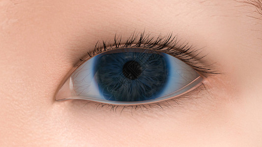 人体眼睛素材角膜损伤设计图片