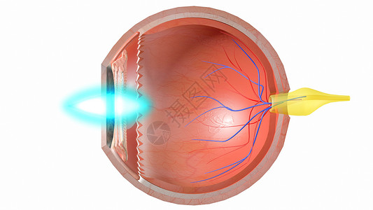 眼部光路人体结构巩膜炎高清图片
