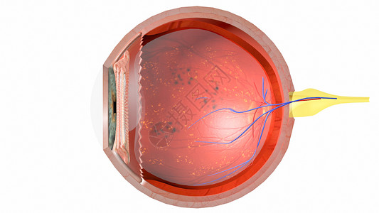 视网膜中央静脉糖尿病眼横断面设计图片