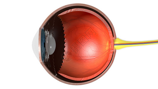 糖尿病眼视网膜组织眼高压设计图片