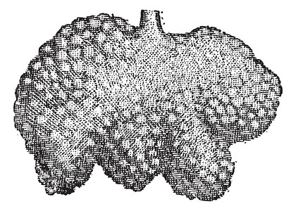 图4肠布鲁纳腺或十二指肠腺图片