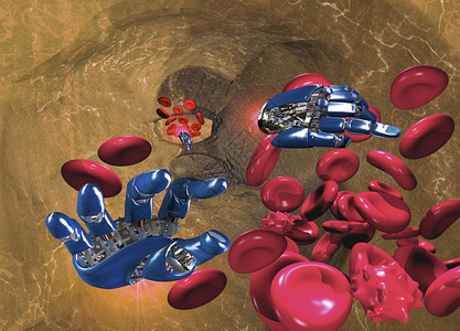 概念图og一个形似人手的纳米机器人在体血流中图片