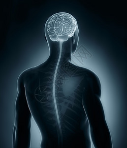 脑和脊椎X射线图片
