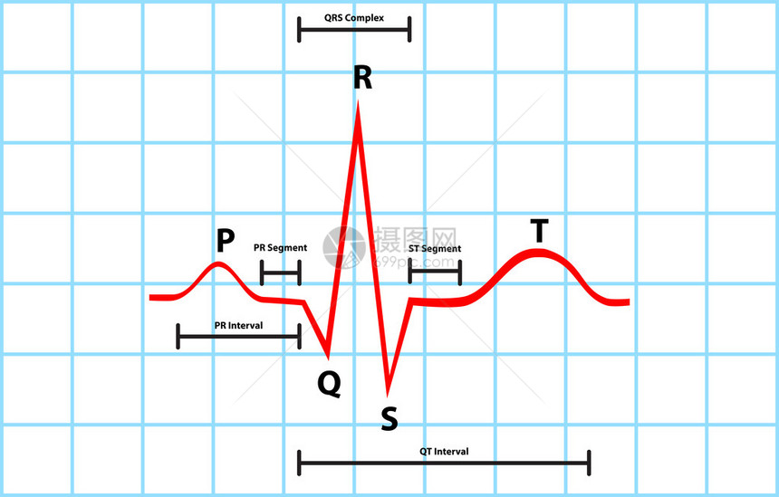 带有心电图的正常气态和脉冲脱极描述矢图片