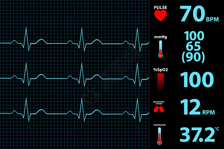 现代心电图显示器显示矢量图图片