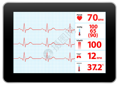 现代电动心电图监视设备图片