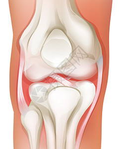 白色背景下人类膝关节的插图高清图片