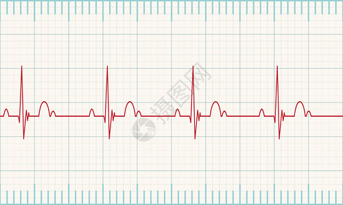 测量白背景心跳速率的医疗心脏监测器EPS图片