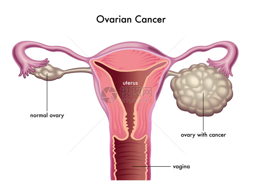 白背景的Ovari图片